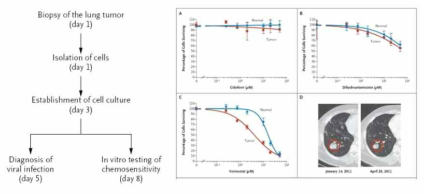 Conditionally Reprogrammed Cell (CRC)를 이용하여 lung cancer의 개인 맞춤형 치료에 성공한 사례