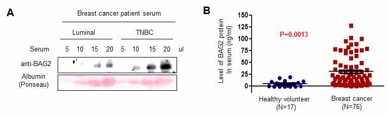 유방암 환자의 혈청 내에서 BAG2 단백질 분비 분석