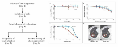 Conditionally Reprogrammed Cell (CRC)를 이용하여 lung cancer의 개인 맞춤형 치료에 성공한 사례