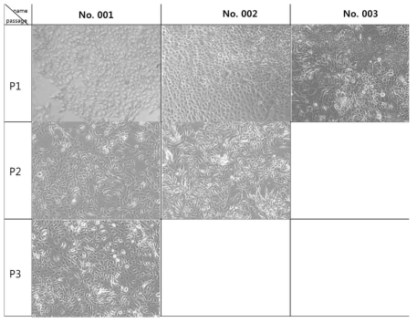 CRC로 확립한 human breast cancer cell의 imaging