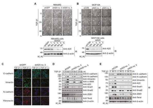 A20 knockdown 세포주를 이용한 TGF-β 매개 EMT에서 A20의 역할 분석