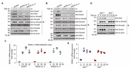 A20 유전자 발현 저하에 따른 Smad 및 Snail1 단백질 발현 및 Snail1 mRNA 수준 분석