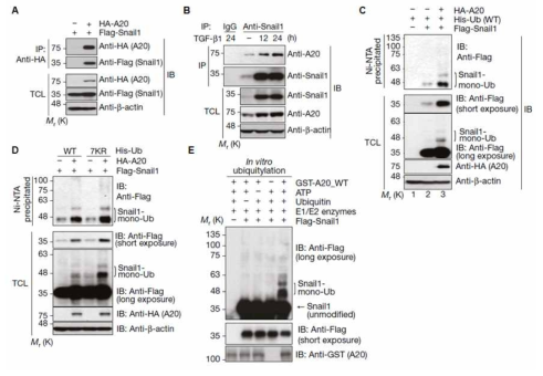 A20 단백질에 의한 Snail1의 다중모노유비퀴틴화