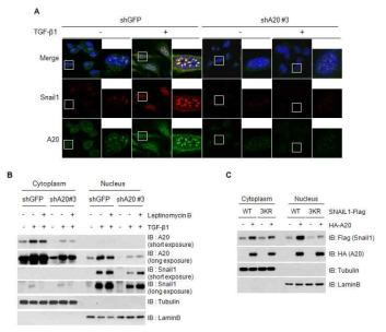 A20 단백질에 의한 Snail1 단백질의 안정화가 일어나는 세포 내 위치 분석
