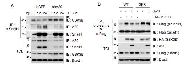 A20 발현 유무에 따른 endogenous 수준의 Snail1 단백질과 GSK3β 단백질의 interaction 변화와 A20에 의한 GSK3β 매개 Snail1 단백질의 인산화 분석