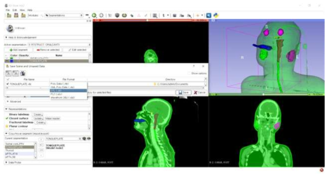 3D Slicer에서 DICOM 파일을 STL 파일로 변환하는 방법