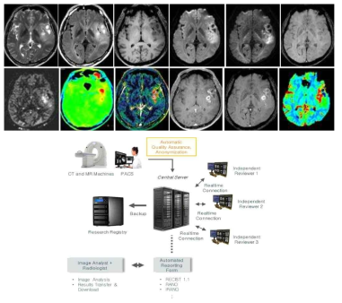 본원 뇌종양 영상 기본 프로토콜과 본 연구자들 주도로 개발한 다기관 임상연구용 영상처리 시스템