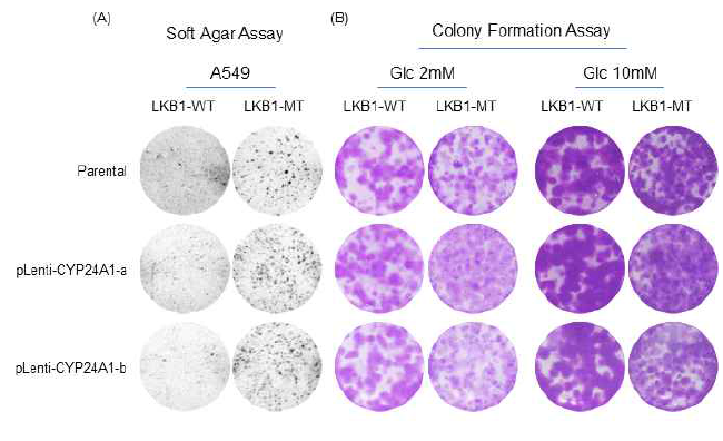 CYP24A1 과발현이 A549 폐암세포 성장 및 생존에 미치는 영향. (A) Softagar assay(B) Colony formation assay