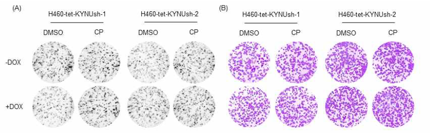 KYNU 발현 억제와 CP 에 의한 NRF2 억제가 H460 폐암세포 성장 및 생존에 미치는 영향 (A)Softagar assay (B) Colony formation assay