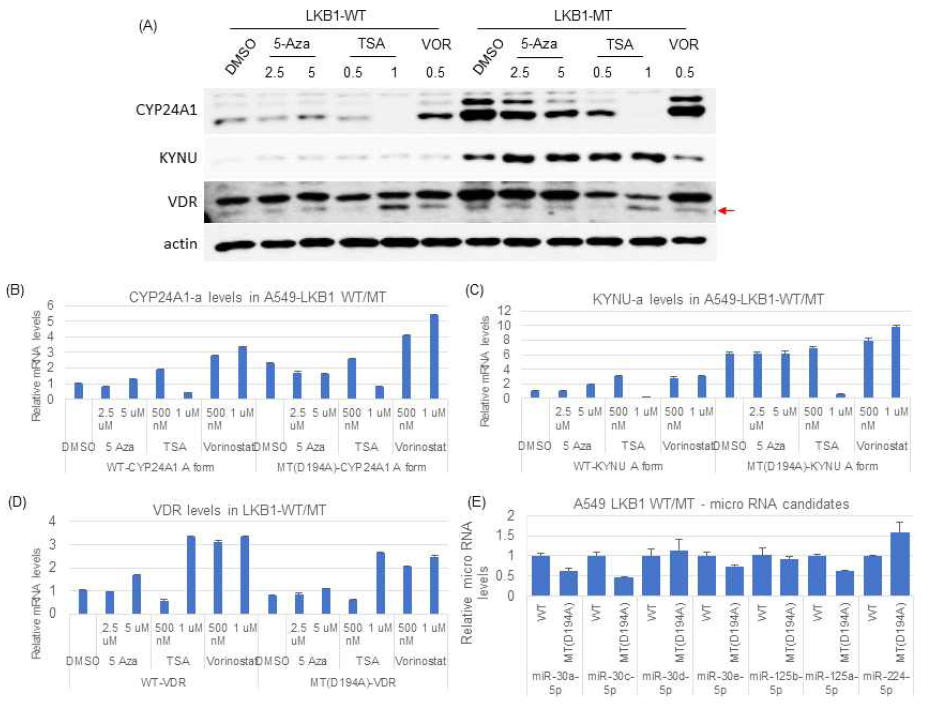 LKB1에 의한 CYP24A1 및 KYNU 발현 억제 기전 연구: (A-D) 후성유전학 및 (E)microRNA 에 의한 조절