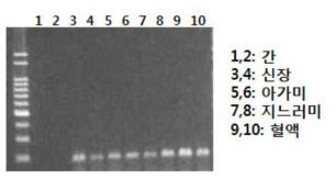 CKM 1 유전자의 조직특이적 발현양상 분석