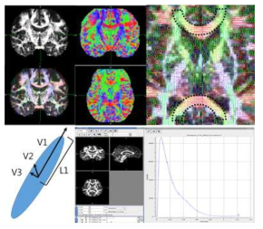 Diffusion tensor images 분석