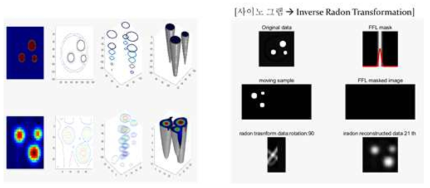 3차원 영상복원 3D volume으로 가시화