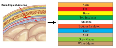 뇌삽입 안테나의 위치 및 주위의 7가지 뇌조직 물질에 대한 그림