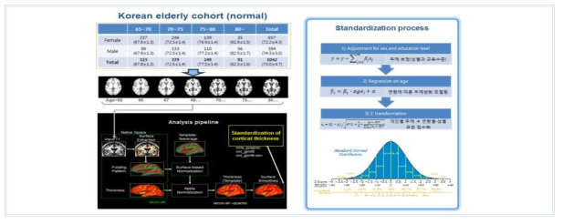 고령 한국인 표준 뇌지도 개발 과정