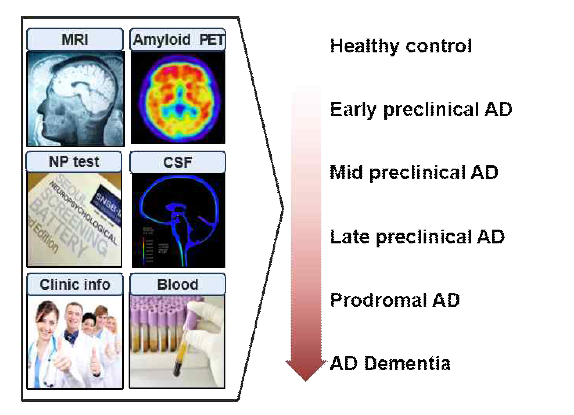다중 빅데이터 기반 알츠하이머병 정밀분류