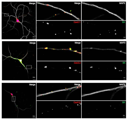 생쥐 해마 신경세포에서 CaV2 채널들(CaV2.1, CaV2.2, CaV2.3)과 BKCa 채널의 군집화 경향. CaV2.1, CaV2.2 채널들도 BK 채널과 군집화 되어 염색되는 패턴을 보임