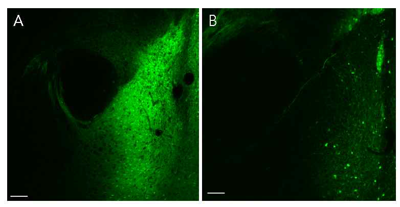 세포 타입 특이적 신경 활성 의존적인 형광 단백질 발현. c-fos-tTA: Vgat-Cre 마우스와 TRE를 가진 DO 바이러스를 이용하여 채널로돕신-eYFP를 흥분성 신경 세포 제한적으로 발현시킴(A). TRE를 가진 DIO 바이러스를 이용하여 신경 활성을 보이는 세포들 중 억제성 신경세포 특이적 채널로돕신-eYFP를 발현시킴(B)