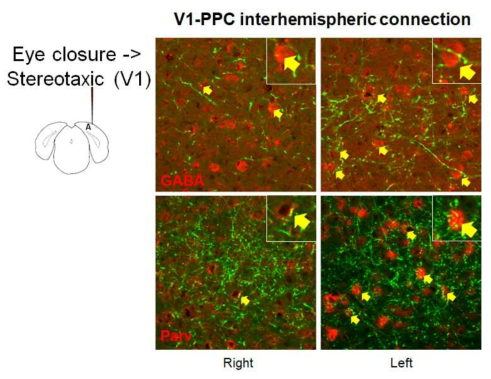 V1-PPC영역에서 왼쪽 눈을 감겼을 때, GABA성/Parvalbumin+ 신경세포 연접의 결과