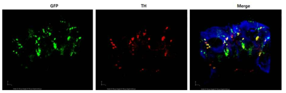 Th-Gal4,UAS-mCD8-GFP 초파리를 이용한 Dopaminergic neuron labeling