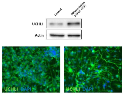 신경 세포 분화 과정 중 UCHL1의 발현