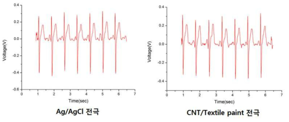 CNT/Textile Paint 혼합 전극과 상용 습식 전극을 이용한 ECG 측정 결과 비교