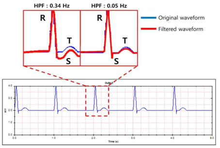 HPF Frequency range에 따른 ECG 신호 왜곡