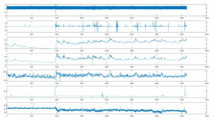 MIT-BIH PhysioNet Multi-parameter DB 중 일부 신호