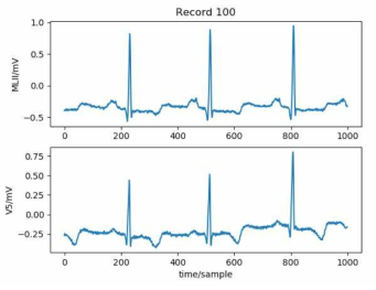 PhysioNet에서 제공하는 QT database ECG 신호의 일부