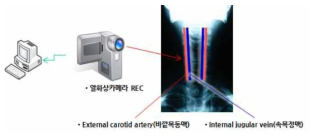 비접촉식 맥박 측정 개념도