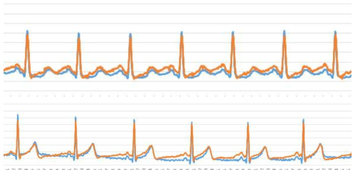 피험자 1번과 9번의 생체신호 예시