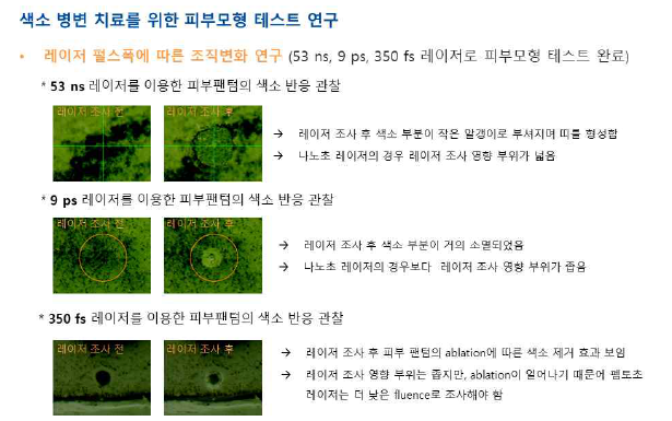 레이저 펄스폭에 따른 조직변화 연구