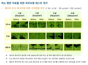 레이저 조사 에너지에 따른 조직변화 연구