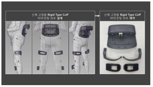 3D 프린팅으로 제작된 Rigid Type Cuff