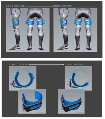 대퇴 고정부 디자인 개선 전(좌), 개선 후(우)