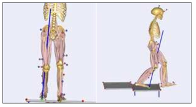 MRI 데이터가 반영된 환자 맞춤형 근골격계 컴퓨터 모델