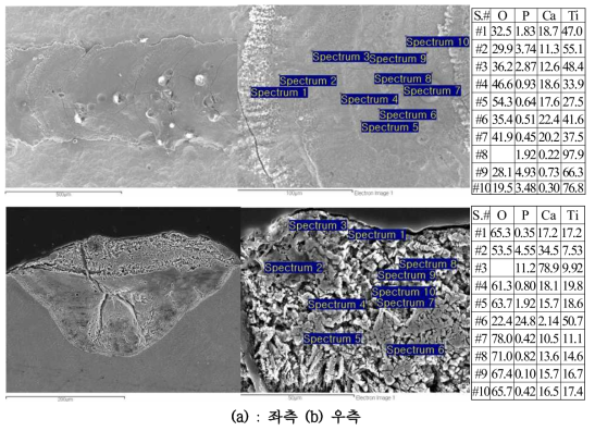 Ti6Al4V substrate 위에 100%HA 분말로 주사속도 14.2 mm/sec., 레이저 출력 90 및 분말공급속도 3 g/min으로 적층한 bead의 SEM (a) 표면모습과 화학조성, 그리고 (b) 단면모습과 화학조성