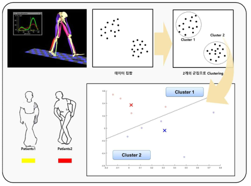 슬관절 질환자 데이터를 기반으로 한 군집화