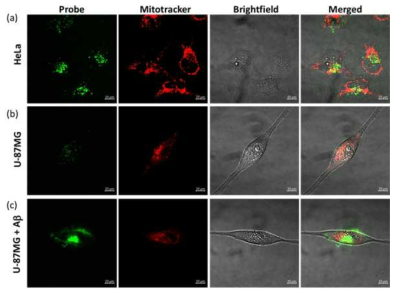 HTRA 프로브인 LFLV를 이용하여, (a) Hela cell, 뇌세포 (U-87)에 아밀로이드 처리 있을 때와 없을 때 (b)-(c) 세포 이미지