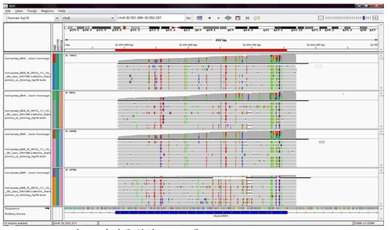 유전체 분석 프로그램(Integrative Genomics Viewer)