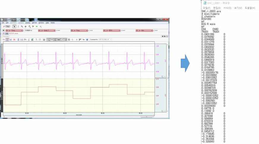 획득된 심전도 데이터 예시
