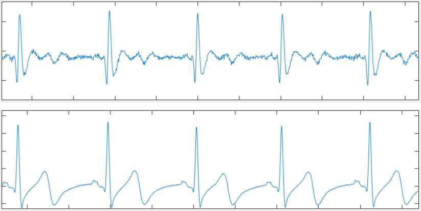 상: 개발된 능동 전극으로 상기 그림의 전극 위치에서 측정한 ECG 파형, 하: 상기 그림의 위치에서 측정한 reference 장비의 ECG 파형