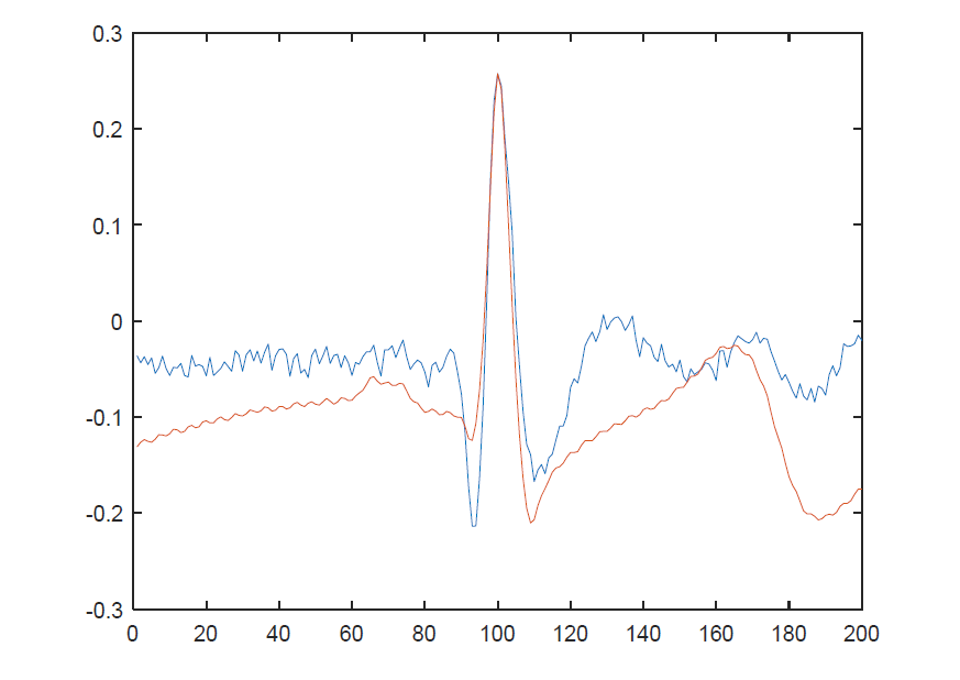 Normalized Beat 파형으로, 파란색은 개발된 시제품에서 측정한 ECG (heart beat), 빨간색은 reference 장비에서 측정한 ECG (heart beat)임