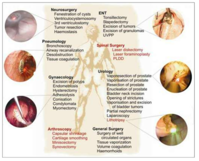 수술용 레이저 의료기기의 적용분야 예시 (자료: IntechOpen)