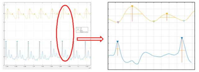 PPG와 ECG Peak Detection