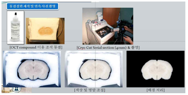 조직 동결법을 이용한 시료의 확보