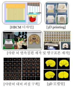 사람뇌 MRI 영상과 정합하여 XIS 연구에 활용할 수 있는 사람 뇌 영구 표본 제작 및 3D 렌더링 완성