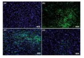 암세포 치료여부 confocal 이미징