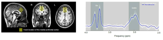 Spectroscopy 기반의 XIS 팬텀 영상에 대한 위치 정보 등록 및 Voxel 기반 spectroscopy 결과