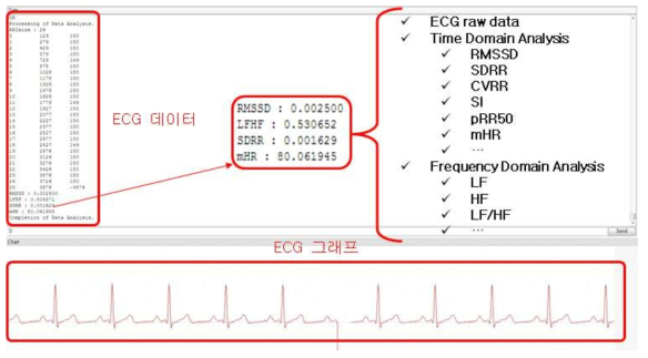 ECG 데이터 분석 결과